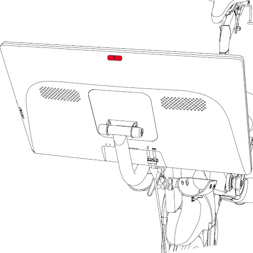 Replacing the Bike Handlebar Screws